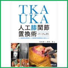 TKA・UKA 人工膝関節置換術パーフェクト