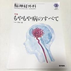 【裁断済み】脳神経外科 2025年3月号　もやもや病のすべて