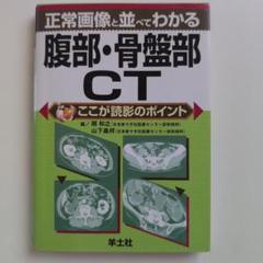 正常画像と並べてわかる腹部・骨盤部CT ここが読影のポイント