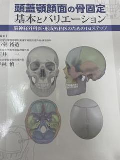 頭蓋顎顔面の骨固定基本とバリエーション = BASIC & VARIATION… 頭蓋顎顔面の骨固定基本とバリエ-ション: 脳神経外科医・形成