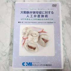 大動脈弁狭窄症に対する人工弁置換術 より大きな人工弁を植込むための工夫
