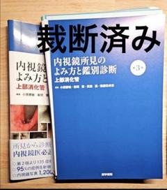 内視鏡所見のよみ方と鑑別診断　上部消化管