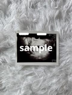 妊娠初期　エコー写真　原本　妊娠7週　感熱紙
