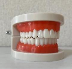 昭和レトロ!貴重な歯の構造疾患模型