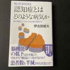 認知症とはどのような病気か 脳の構造としくみから全体像を理解する
