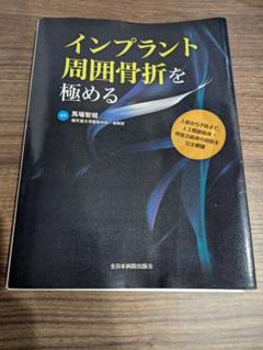 2025年最新】インプラント周囲骨折を極めるの人気アイテム