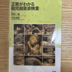 【裁断済】正常がわかる胎児超音波検査
