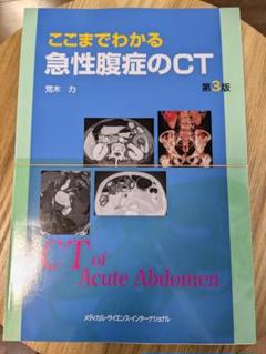 ここまでわかる急性腹症のCT 第2版 | 荒木 力 |本 | 通販 | Amazon