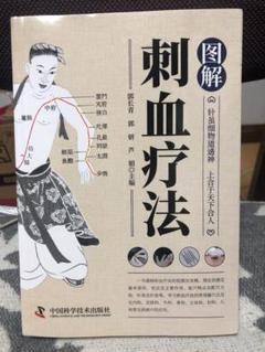 中国語・医学書・医療・医学・解剖・治療 刺血療法 図解医学書 中国語簡体字 新品 - メルカリ