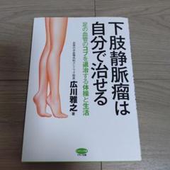 下肢静脈瘤は自分で治せる 足の血管のコブを退治する体操と生活
