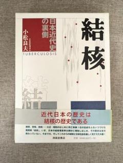 【希少本・外箱付き】結核 日本近代史の裏側 　小松良夫