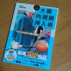 2025年最新】カール先生の大腸内視鏡挿入術 non-loop法 の挿入