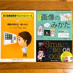 早わかり画像のみかた : マンガでわかる正常・異常ポイント❇️画像の見かた使いかた