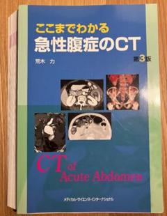 ここまでわかる急性腹症のCT ここまでわかる急性腹症のCT | 荒木 力 |本 | 通販 | Amazon