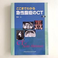2025年最新】急性腹症のctの人気アイテム - メルカリ