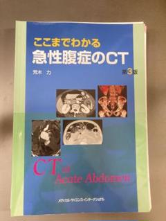 2025年最新】急性腹症のctの人気アイテム - メルカリ