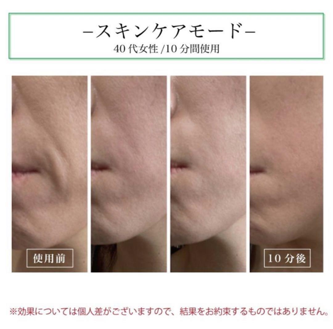 『美品』 LEDitch Tri-Pro 1台3役美容器レディッチ トリプロ