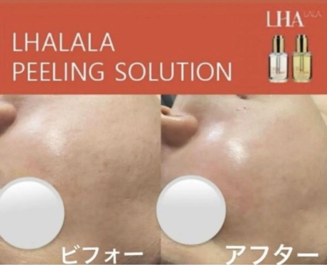 【即日発送】LALAララピール・洗顔セット　2回分ハケ1本プレゼント