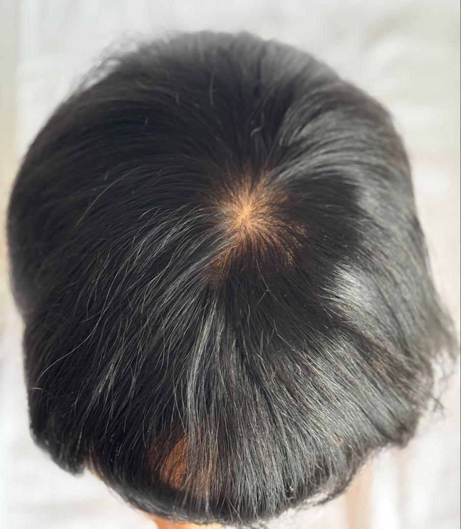 【14×22】メンズ ウィッグ 男性用 かつら 100%人毛 黑色