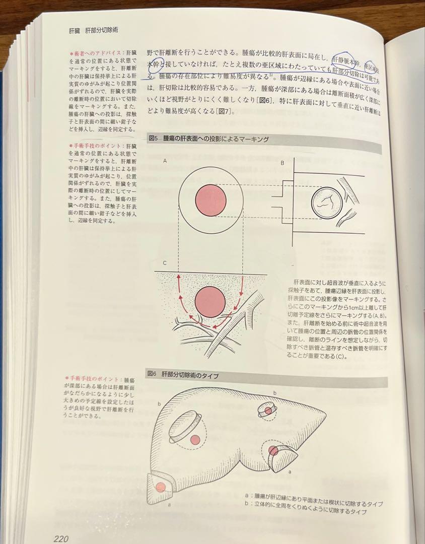 卒後5年でマスターする消化器標準手術 - メルカリ