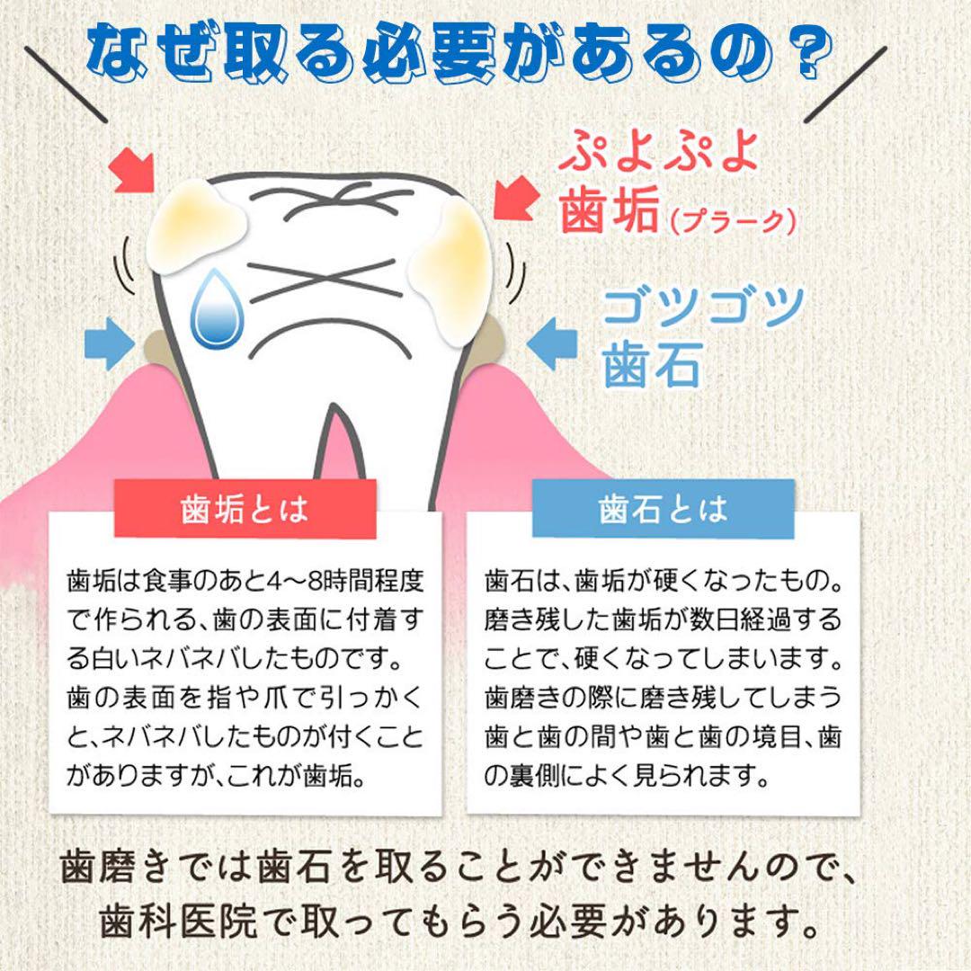 オーラルケアツール 歯石取り