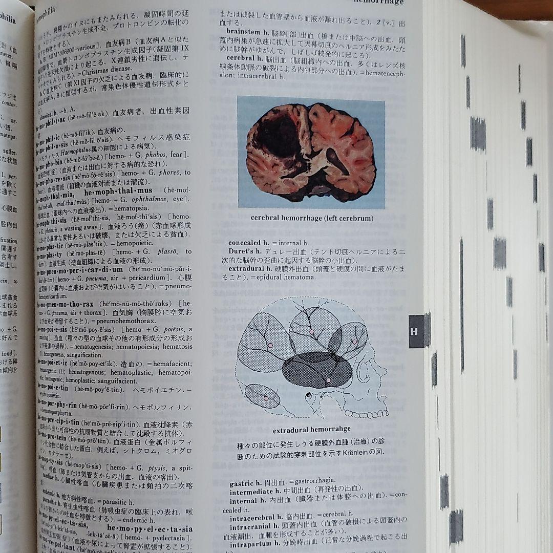 ステッドマン医学大辞典 英和・和英 カラー版 - メルカリ