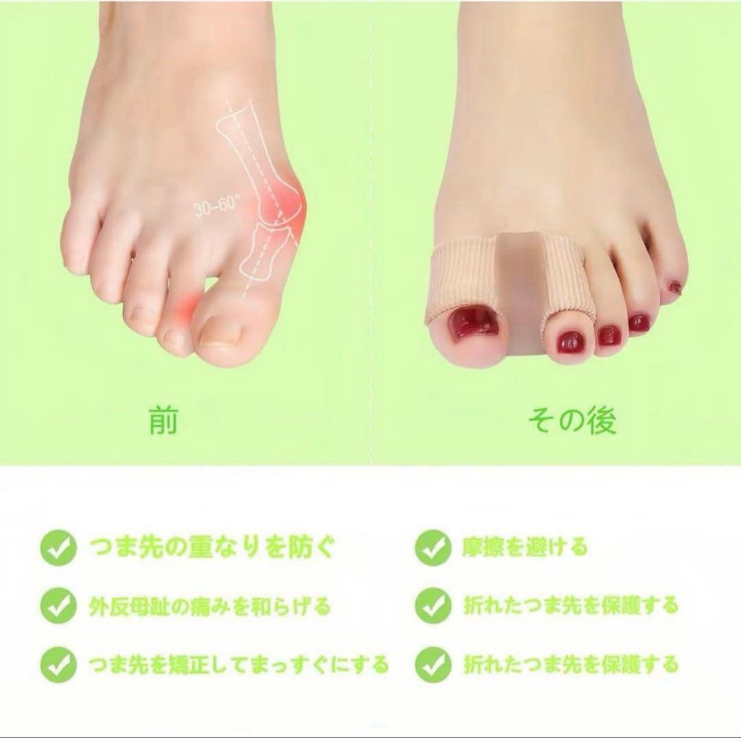 足指サポーター 外反母趾 靴下上からOK 歩行補助 足底ケア