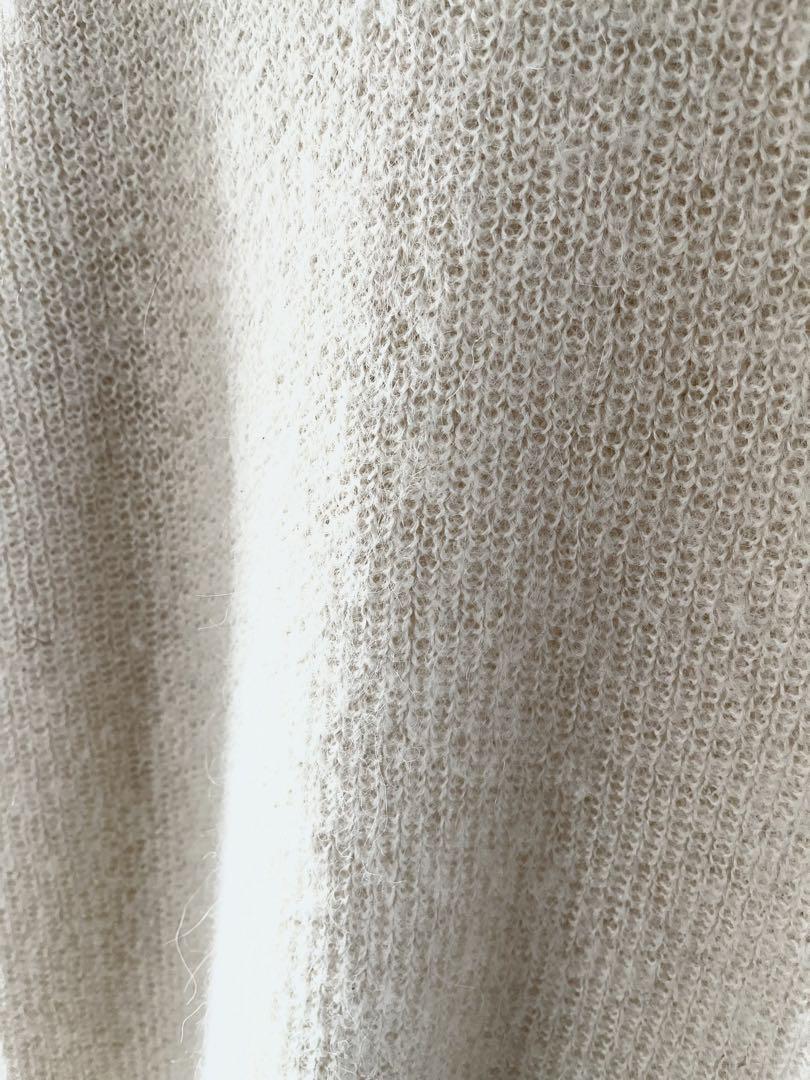 Acne