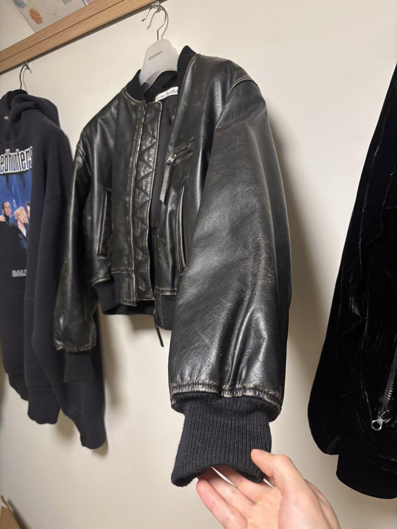 Acne