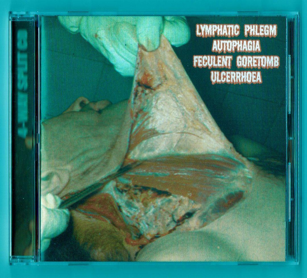 ゴアグライン〇LYMPHATIC PHLEGM 02年4-Way Split目立った傷や汚れなし