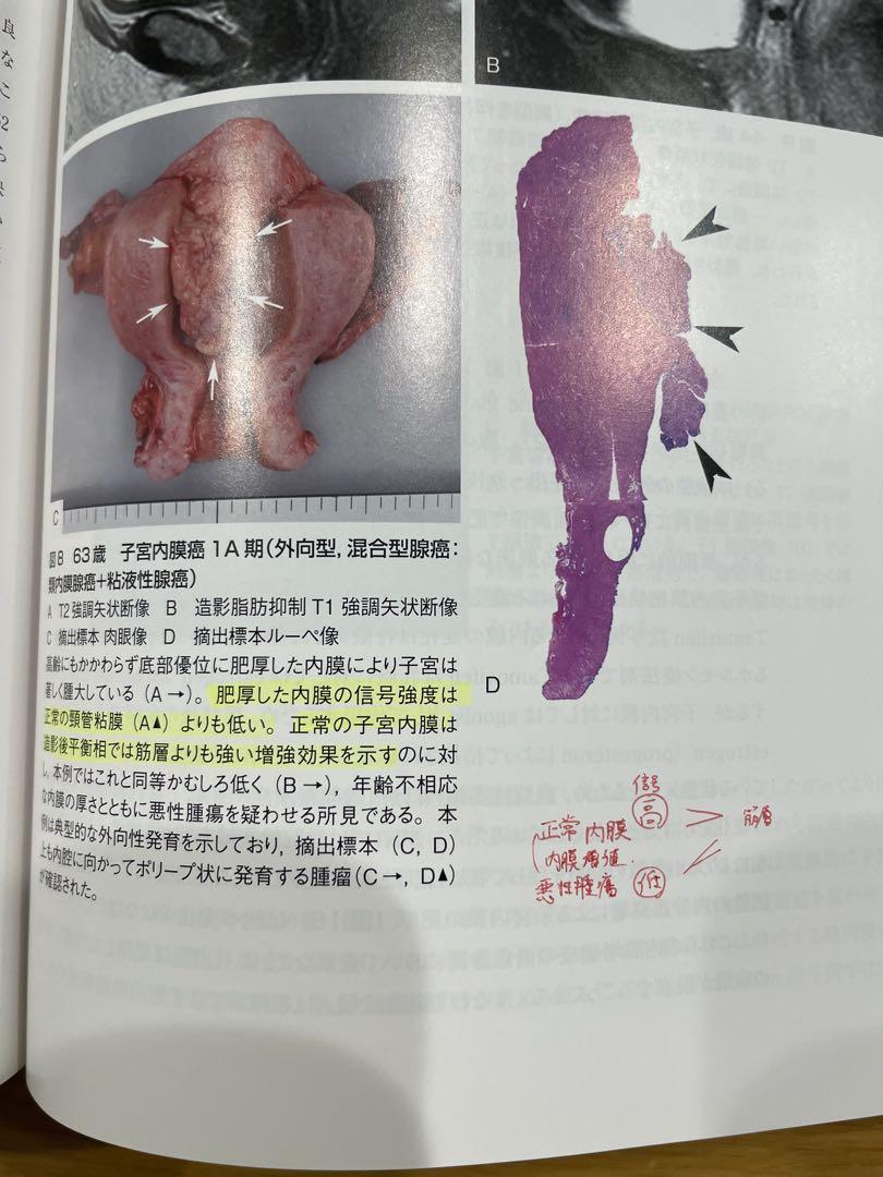 産婦人科の画像診断 田中優美子著