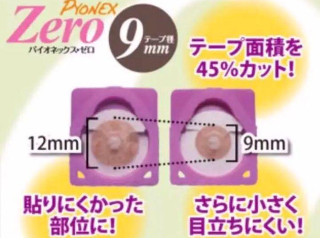 気になるほうれい線に！刺さない美容鍼♥300本　肩こりや足のむくみにも！