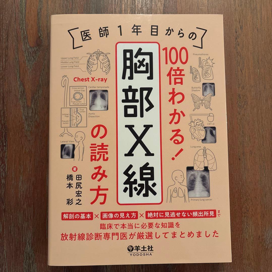 医師1年目からの 100倍わかる! 胸部X線の読み方