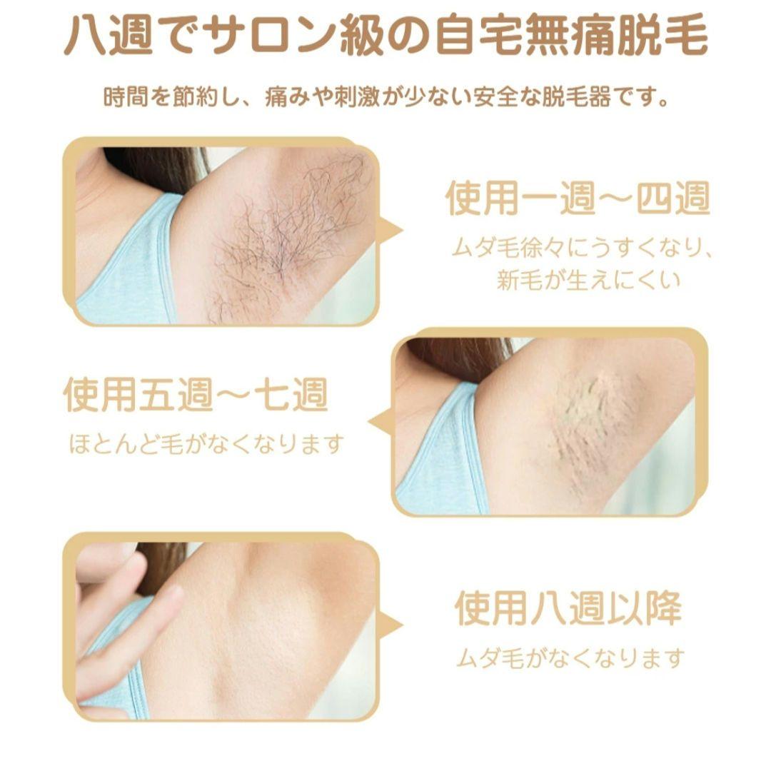 新品未使用 脱毛器 VIO対応 顔 全身 IPL光脱毛器 メンズ レディース