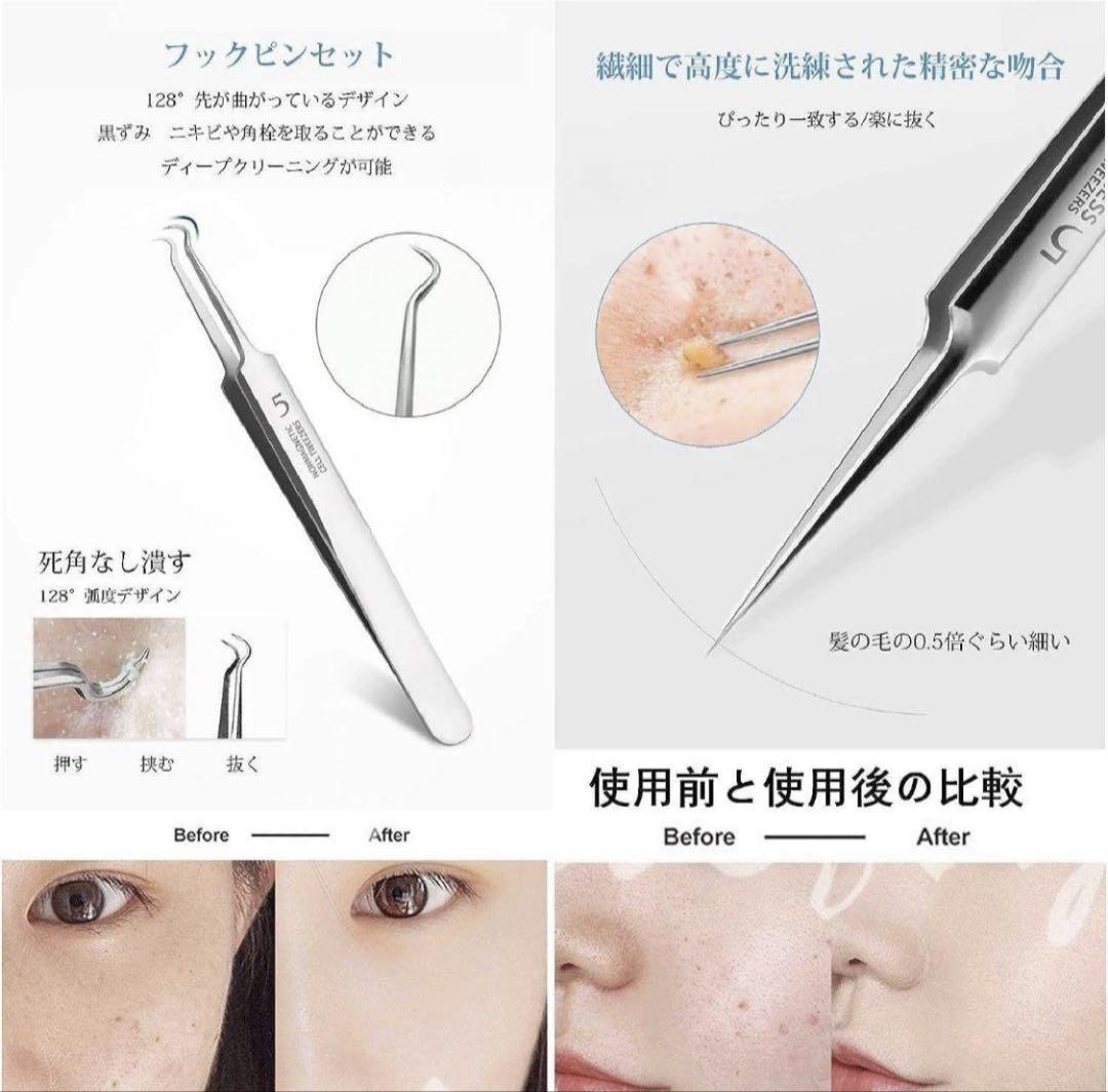 ☆ニキビケア☆ピンセット☆毛穴ケア☆ステンレス☆コメドプッシャー☆角栓取り☆角栓