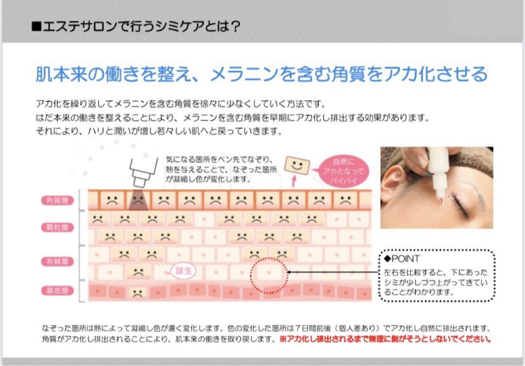 E-shi\"'(i)★新品★送料無料★シミケア機器★タッチパネル式★