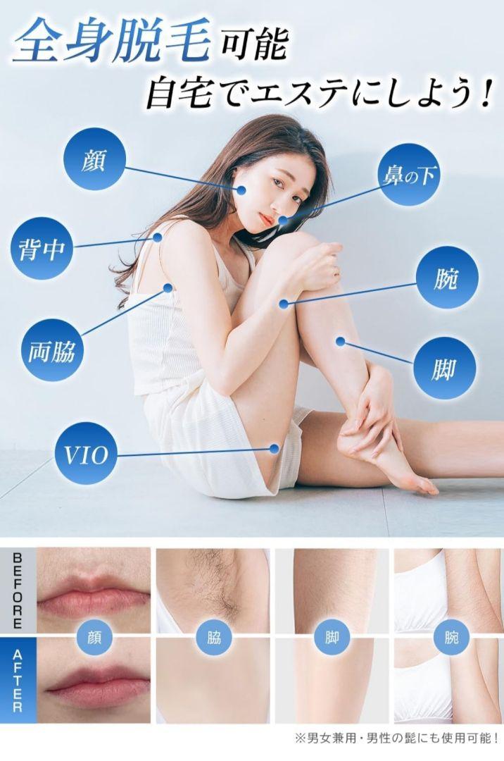 KosBeauty 脱毛器