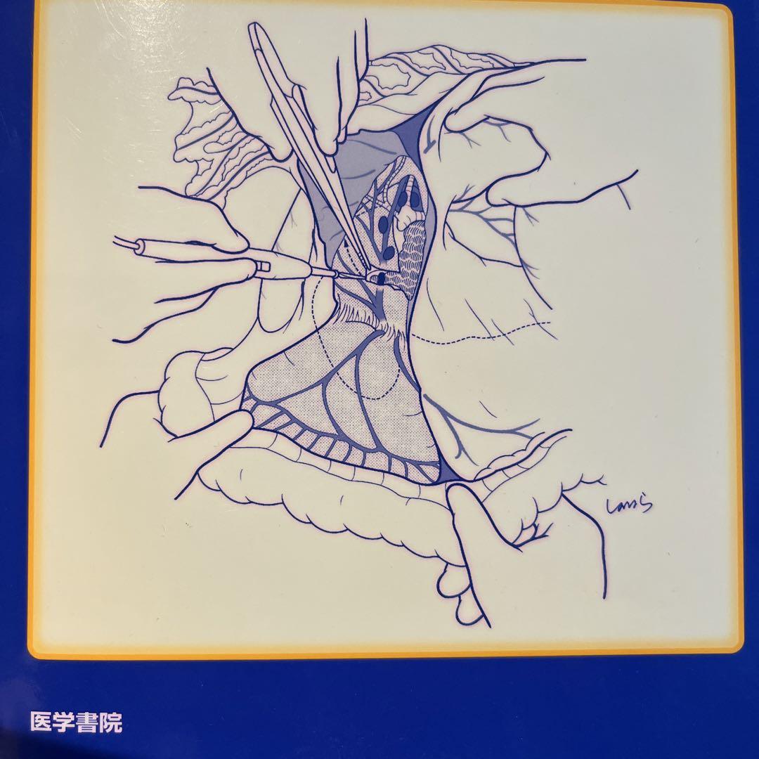 イラストレイテッド外科手術 : 膜の解剖からみた術式のポイント