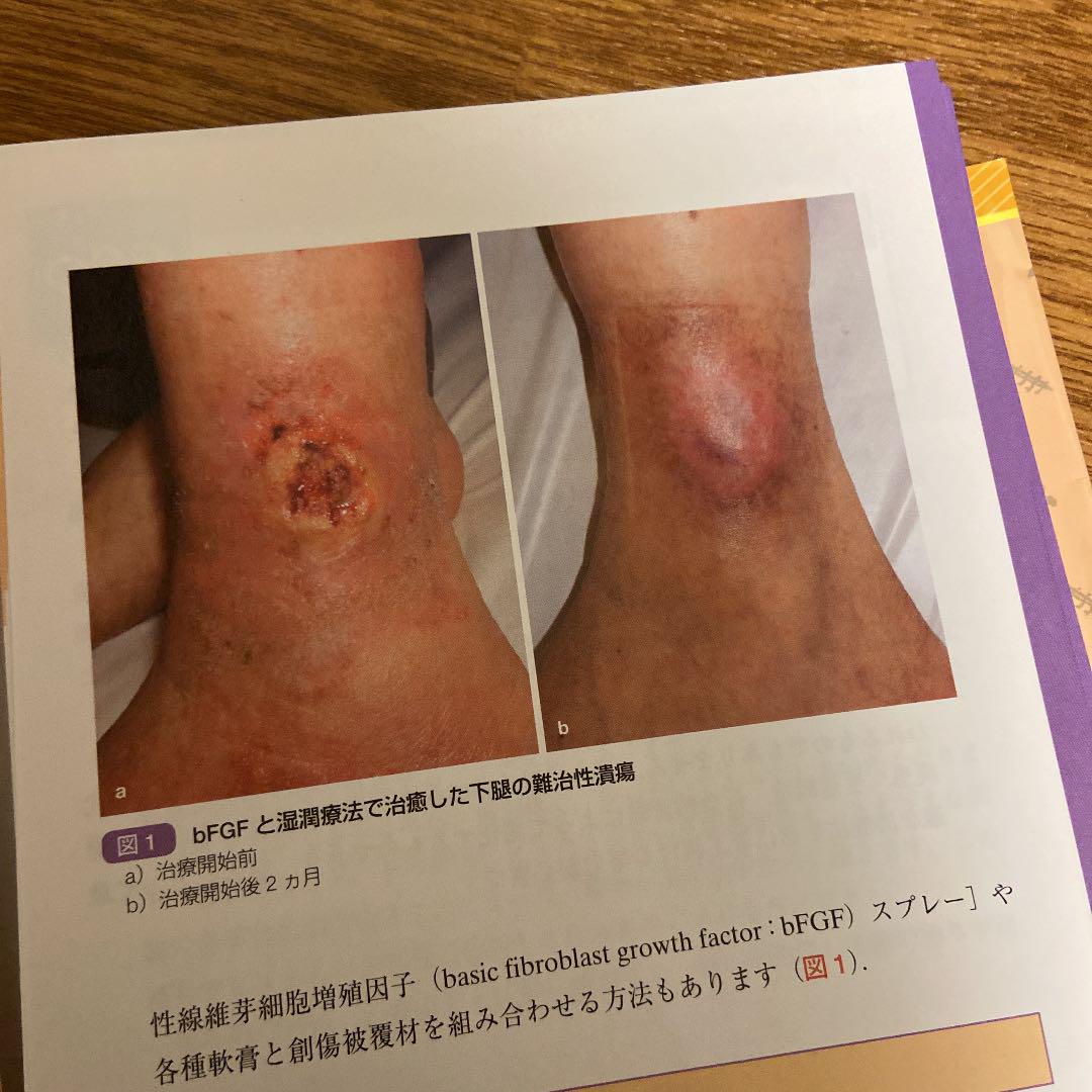 裁断済】傷あと治療 小川令 克誠堂出版 ケロイド 本 医学書 形成