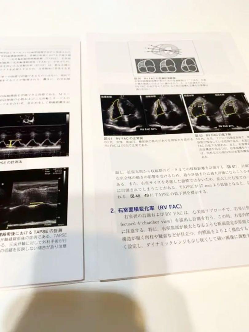 心臓超音波テキスト 裁断済み - www.splashecopark.com.br 心臓超音波テキスト 裁断済み - www.splashecopark.com.br