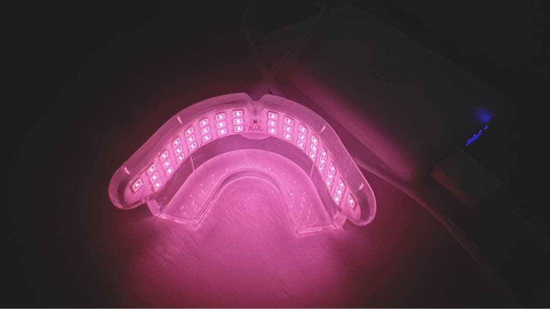 pbmヒーリング 拡張型 healing オルソパルス 矯正加速装置 pbmヒーリング 拡張型 healing オルソパルス 矯正加速装置