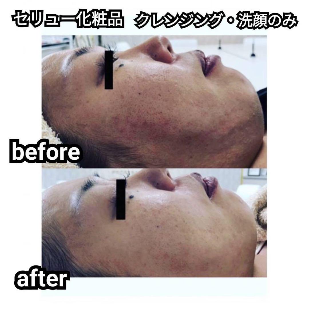 HERMOSA SERIEUX クレンジング&洗顔