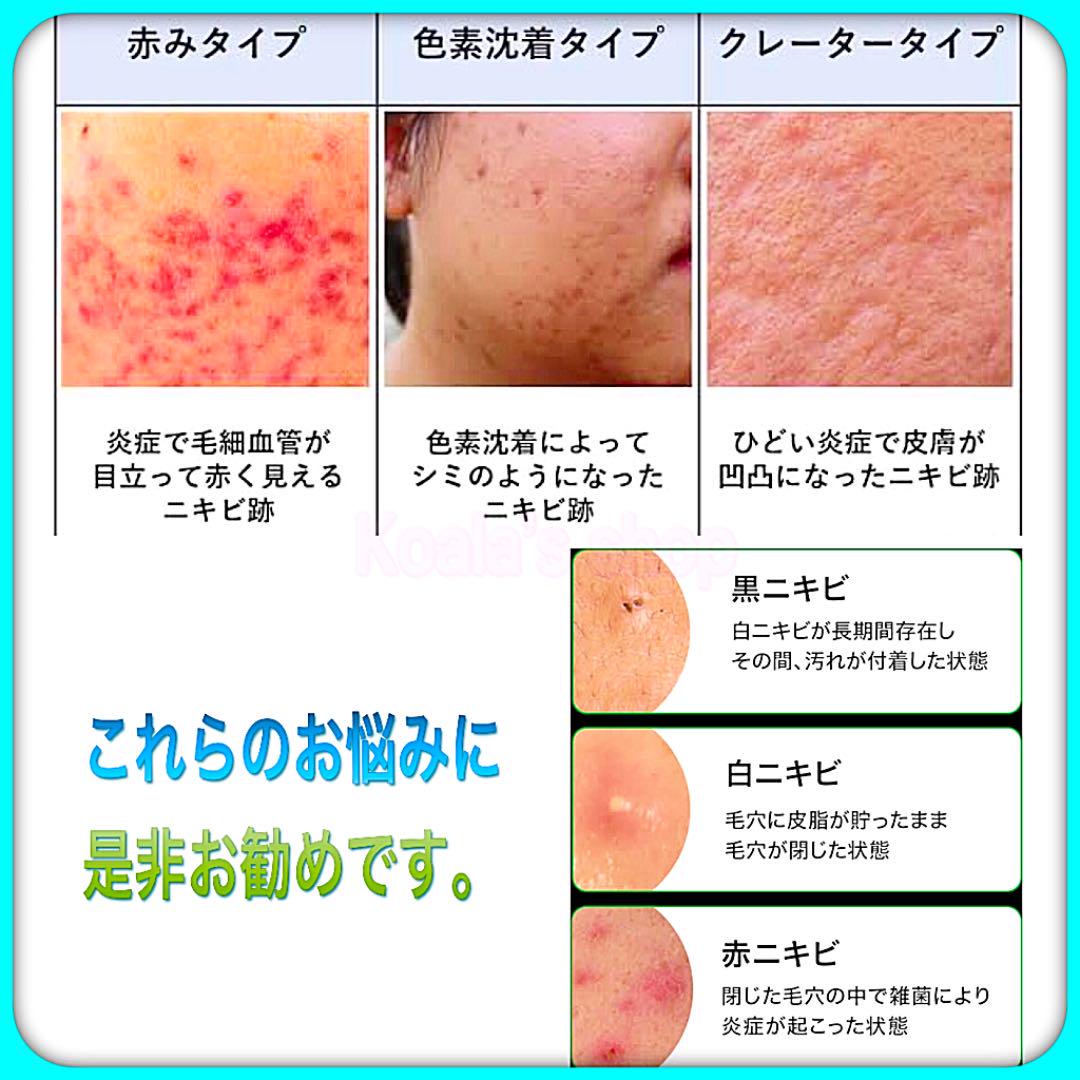 直販販売済み BREYLEE アクネトリートメントセラム★3本★+パッチ3パック 直販販売済み BREYLEE アクネトリートメントセラム★3本★+パッチ3パック