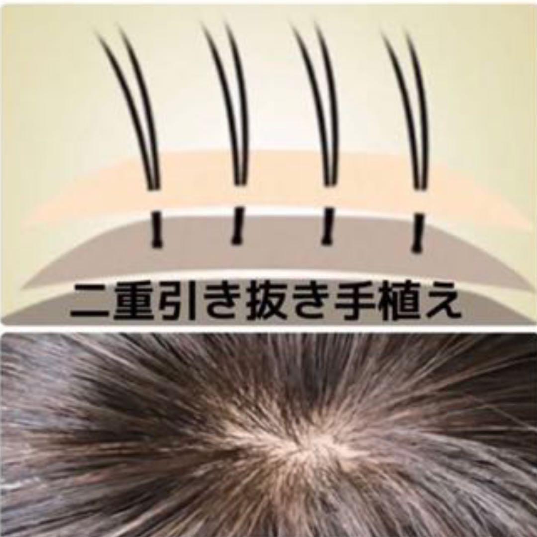26cmタイプ】前髪付き総手植え人毛100% ブラウン✨ヘアピース