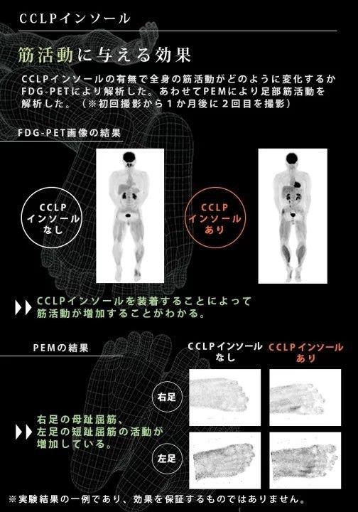 人気!BMZアシトレインソールゴルフカーボン 画像4