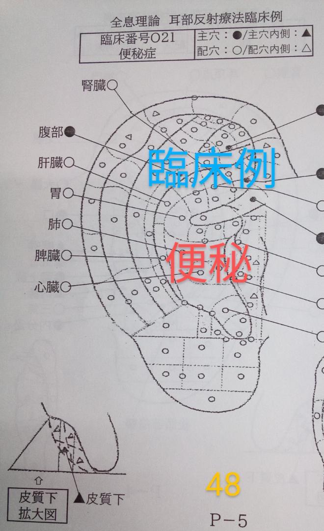 B2：耳つぼ:臨床48例集本+躯体全図ラミネート+解説プリント
