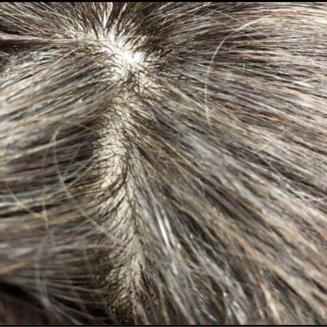 HairDre ヘアドレ L② 人毛100%ウィッグ ダークブラウン黒茶