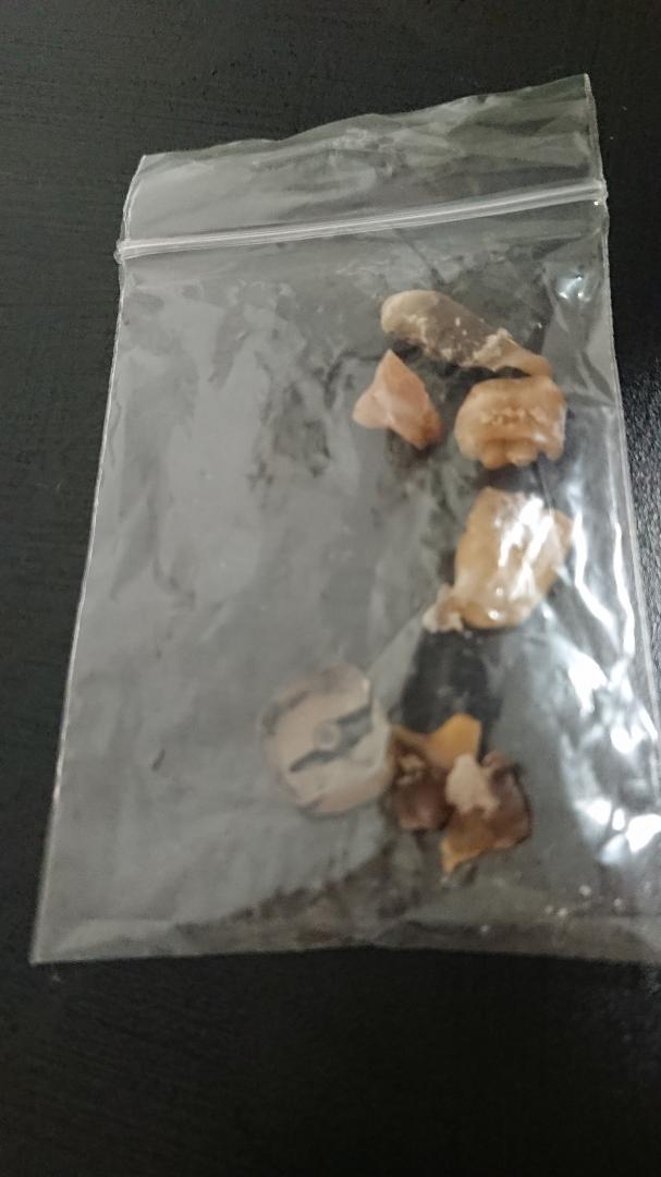 抜歯　クラウン　歯根　骨　標本