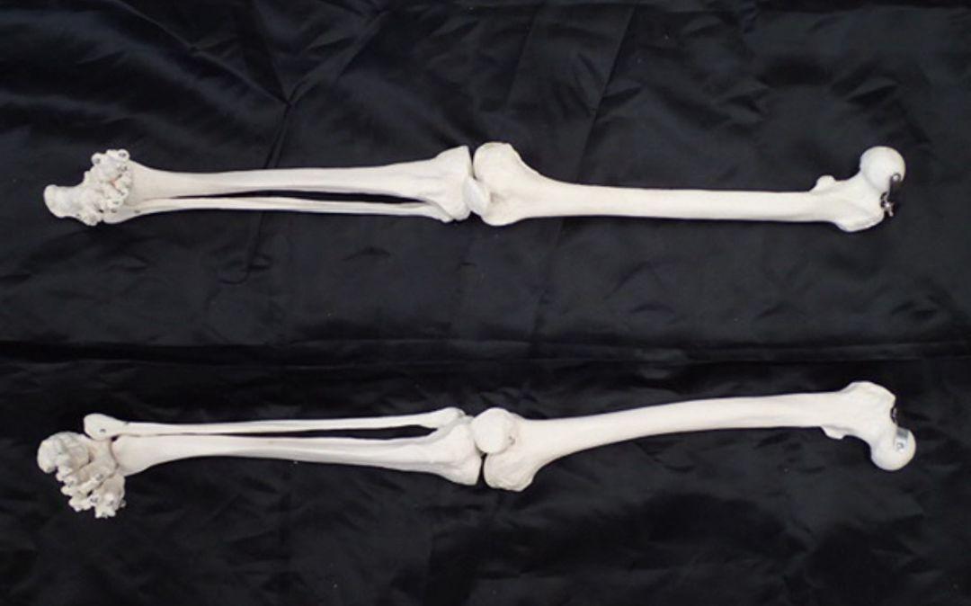 人体骨格模型/人体模型/全身/全長 約170cm/医学/医療/教材/スタンド