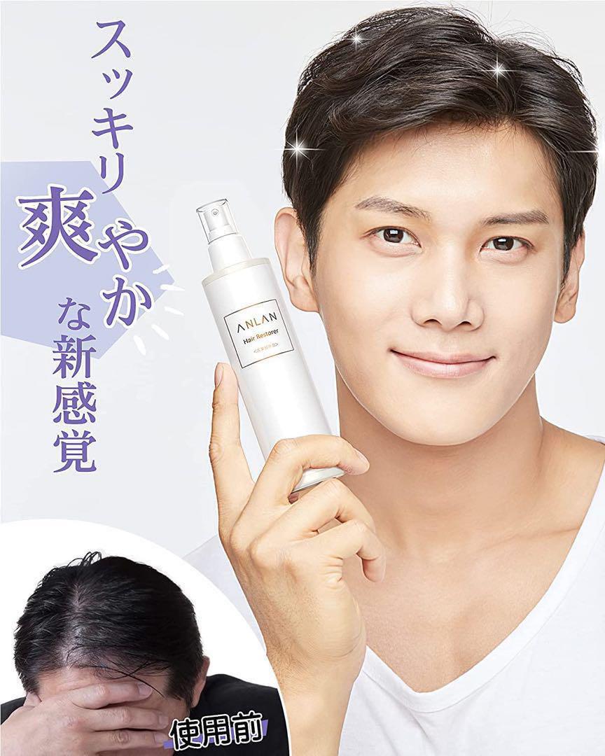 ANLAN 育毛剤 150ml 3本 育毛促進 抜け毛予防 薄毛 切れ毛 抜け毛